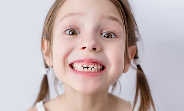 حقایق و اهمیت دندان های شیری کودک