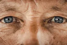 تاثیر دیابت بر سلامت چشم