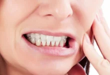 تاثیر دندان قروچه بر سلامت دندان ها و فک